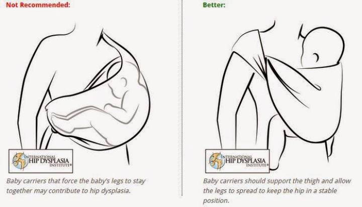 curvas-normales-de-la-columna-3 Portear sí, pero no de cualquier manera. - Nascere - Maternidad y Crianza
